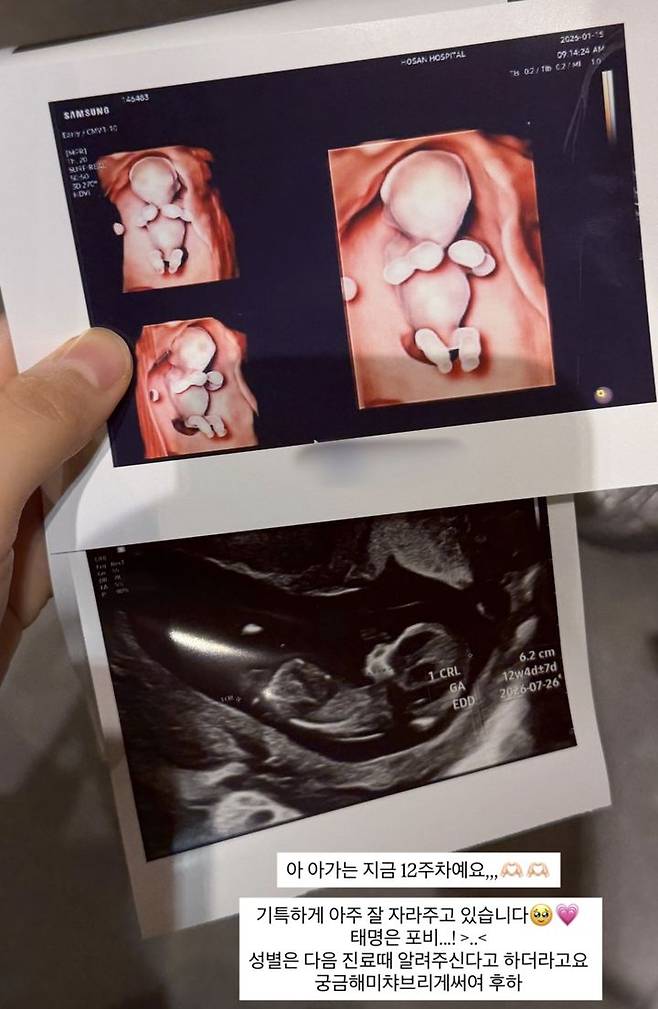 [서울=뉴시스] 인플루언서 김지영이 19일 태명을 공개했다. (사진=김지영 인스타그램 캡처) 2026.01.19. photo@newsis.com *재판매 및 DB 금지