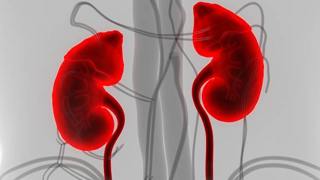 콩팥 기능이 망가진 사람의 절반 이상이 심장병으로 숨지는 원인이 밝혀졌다. 미국 연구팀은 병든 콩팥에서 심장을 직접 손상시키는 독성 물질이 만들어진다는 사실을 알아냈다. 사진=게티이미지뱅크