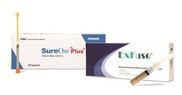 동종골이식재 익스퓨즈.(사진=한스바이오메드)