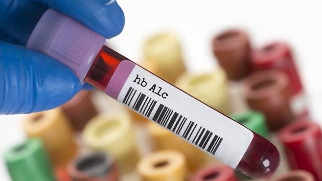 당화혈색소 수치를 떨어뜨리는 데는 무엇보다 식습관 개선이 중요하다｜출처: 클립아트코리아