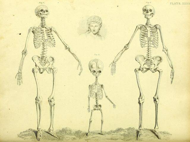 19세기 스코틀랜드 해부학자인 존 바클레이의 주장을 토대로 그려졌다고 알려진 해골 그림. 맨 오른쪽의 여성 해골은 실제보다 두개골은 더 작게, 골반은 더 넓게 그려져 있다. 위키피디아 커먼스