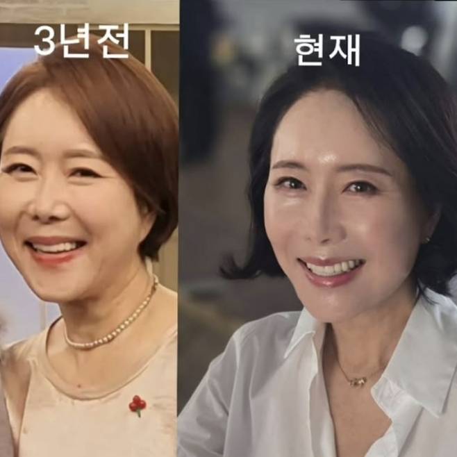 아나운서 출신 방송인 윤영미(63)가 안면거상술 후 확 달라진 얼굴을 공개했다. 윤영미 인스타그램 캡처