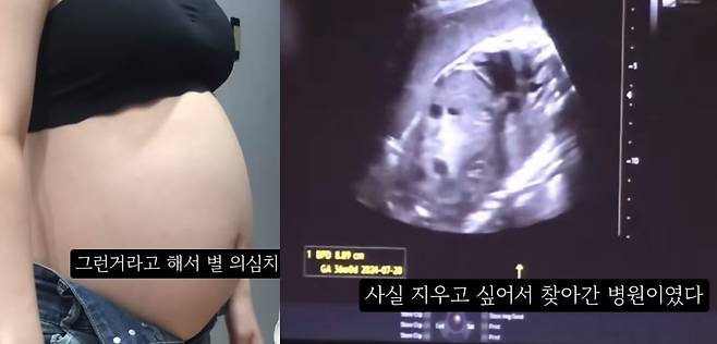 지난해 임신 36주자 태아의 초음파 사진을 공개하며 낙태 사실을 공개한 유튜브 영상. /유튜브 캡처