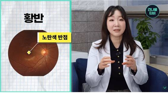 안과 전문의 김선영 원장은 눈 건강에 도움이 되는 식품 다섯 가지를 소개했다./사진=유튜브 채널 ‘건나물TV’