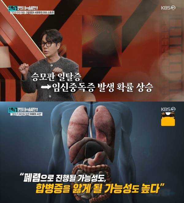 KBS 2TV '셀럽병사의 비밀' 캡처