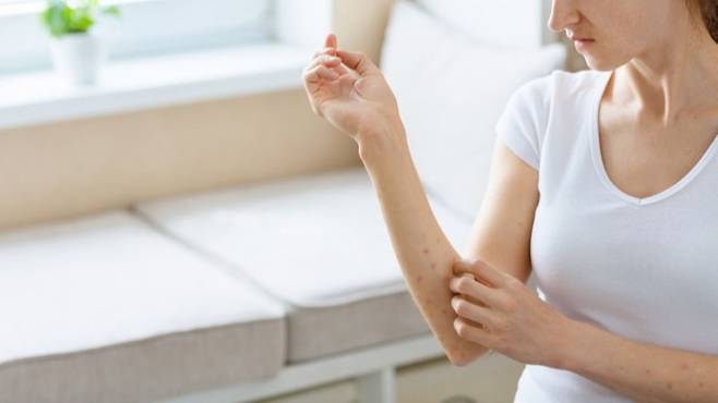 피부 두드러기 원인은 '전신 면역 반응' 이상일 수 있다ㅣ출처: 게티이미지뱅크