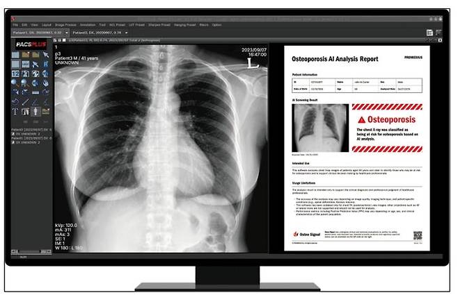 [서울-뉴시스] 5일 의료기기업계에 따르면 노을, 프로메디우스, 휴이노 등 국내 의료AI 업체들은 오는 9일부터 두바이에서 개최되는 글로벌 헬스케어 전시회 'WHX(World Health Expo) Labs 두바이 2026'에 참가한다. (사진=프로메디우스 제공) 2026.02.06. photo@newsis.com *재판매 및 DB 금지