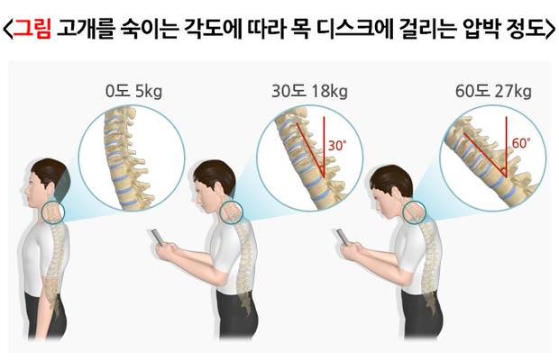 고개를 숙이는 각도에 따라 목 디스크에 걸리는 압박 정도. 사진 제공=국가건강정보포털
