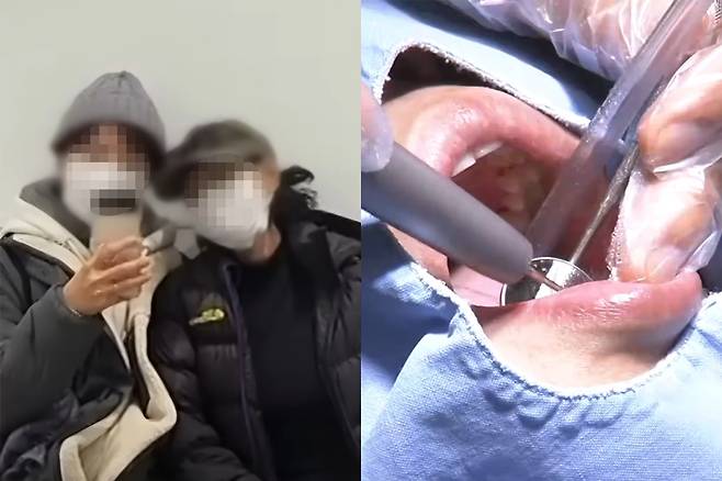 지난해 12월30일 서울 강남의 한 치과에서 치료를 받다 숨진 70대 여성이 진료를 기다리며 딸과 함께 찍은 사진. 오른쪽은 치과 치료 자료화면. MBN 보도화면 캡처