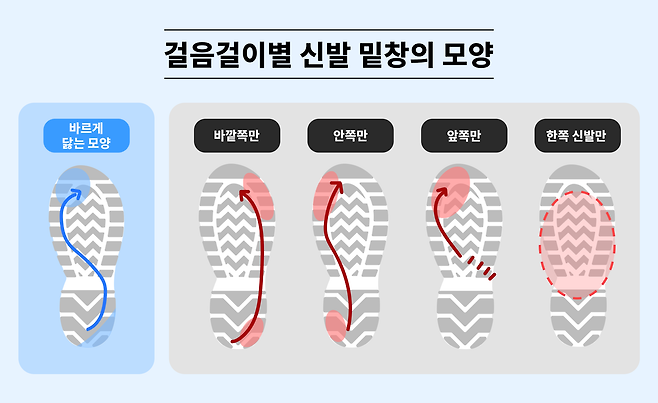밑창이 닳은 위치를 보면 보행 습관과 체중 분산 상태를 가늠할 수 있고 이는 무릎과 고관절, 발목 등 관절 건강과 밀접하게 연결된다.
제일정형외과병원 제공