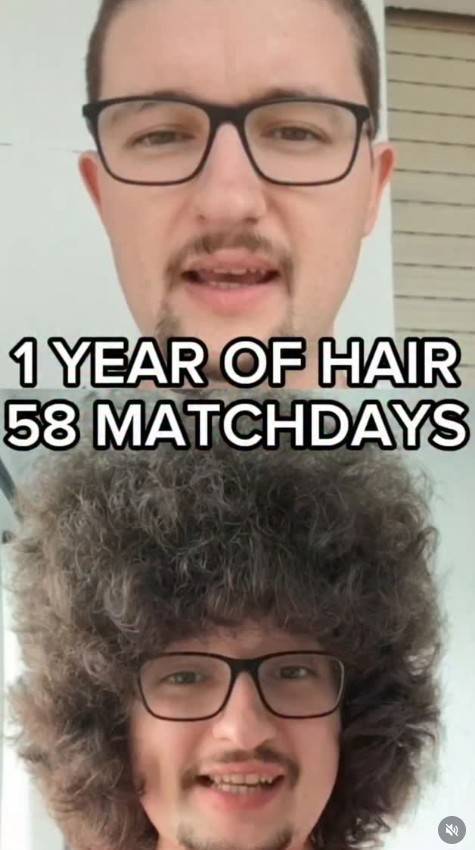 1년여만에 변한 일렛의 머리모양.  [프랭크 일렛 SNS. 재판매 및 DB 금지]