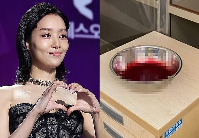 배우 차주영이 비출혈(코피) 증상으로 수술을 받은 가운데, 과거 심각했던 출혈량을 공개했다. /사진=뉴스1, 차주영 인스타그램