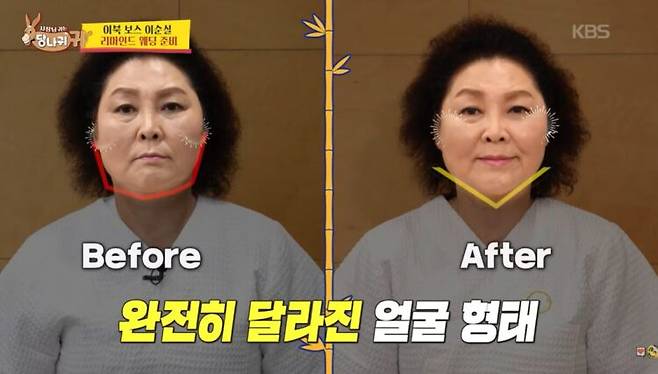 발의 체중과 압력을 이용해 얼굴과 턱선을 자극하는 방식이다. 사진=KBS2 '사장님 귀는 당나귀 귀'