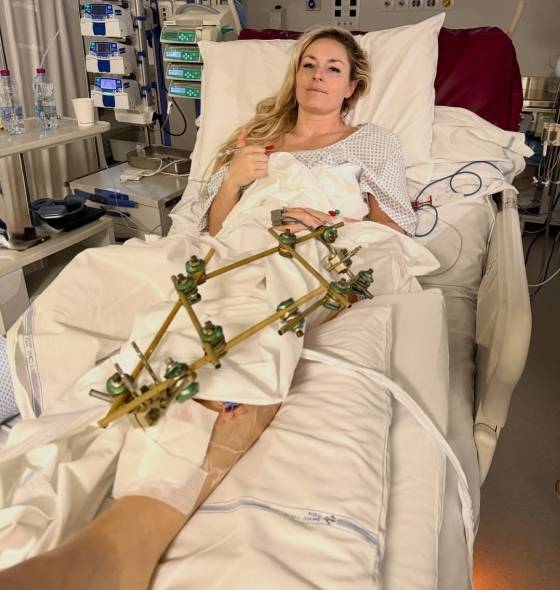 병상에 누워있는 린지 본. /사진=린지 본 개인 사회관계망서비스(SNS) 갈무리