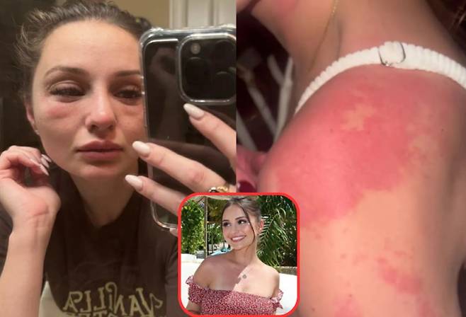 에어컨 속 곰팡이 때문에 얼굴이 붓고, 피부에 발진이 생긴 여성의 사연이 보도됐다. 사진=더선