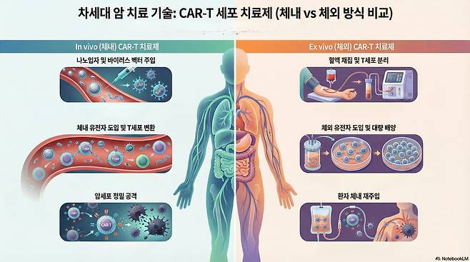 CAR-T 세포를 체내에서 직접 만드는 방식을 설명한 인포그래픽. 세포를 채취해 몸 밖에서 만든 뒤 다시 환자 몸에 주입하던 기존 방식과 구별된다./노트북 LM 활용