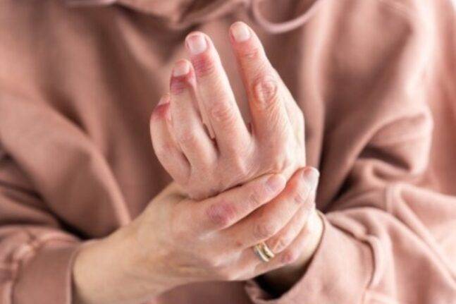 곱던 내 손을 지키려면 평소 핸드크림, 자외선차단제를 꾸준히 바르며 관리해줘야 한다. 사진=게티이미지뱅크