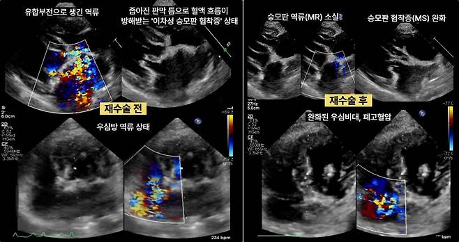 재수술 전후 심장초음파 검사 결과(넬동물의료센터 제공) ⓒ 뉴스1