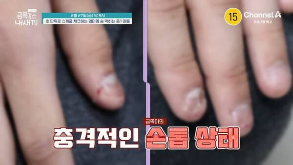 ⓒ채널A '요즘 육아 – 금쪽같은 내 새끼' 방송 캡처