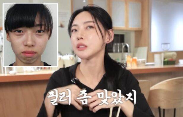 김민지가 필러 시술을 고백했다. 사진=유튜브 채널 '김민지 KIMMINGEE' 영상 캡처