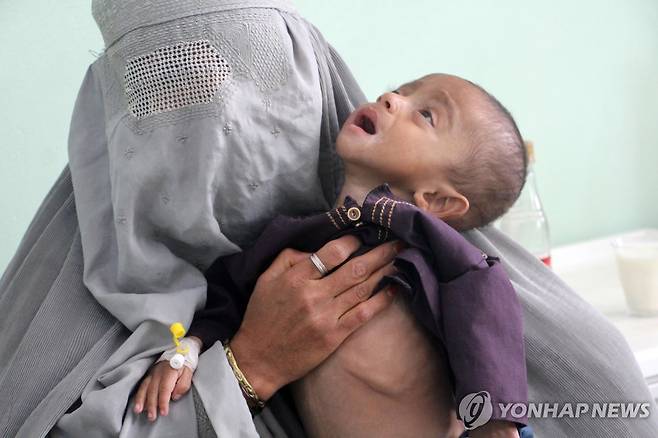 급성 영양실조 겪는 아프간 어린이 [EPA 연합뉴스 자료사진. 재판매 및 DB 금지]