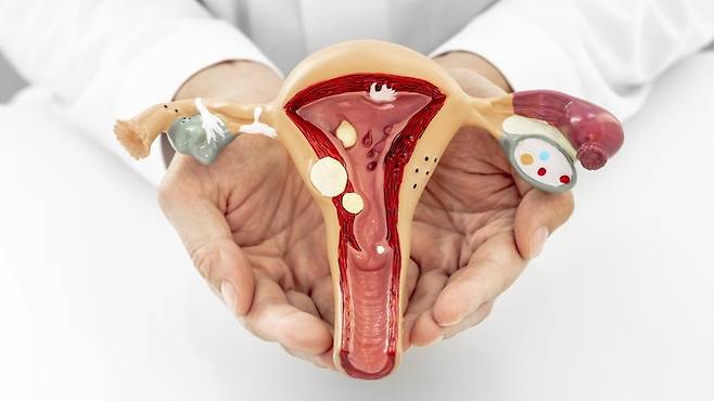 일교차가 큰 시기, 자궁 건강을 챙길 때다｜출처: 클립아트코리아