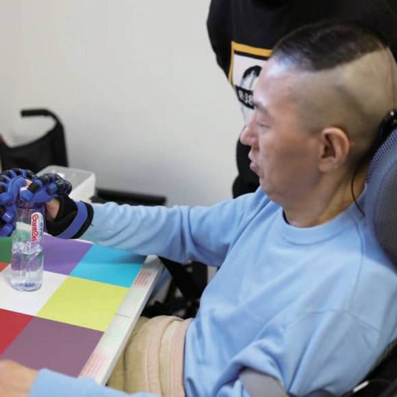 2025년 10월24일 NEO 브레인칩 인터페이스 시스템을 최초로 이식받은 환자가 의수의 도움으로 물체를 잡고 있다. ⓒ뉴시스