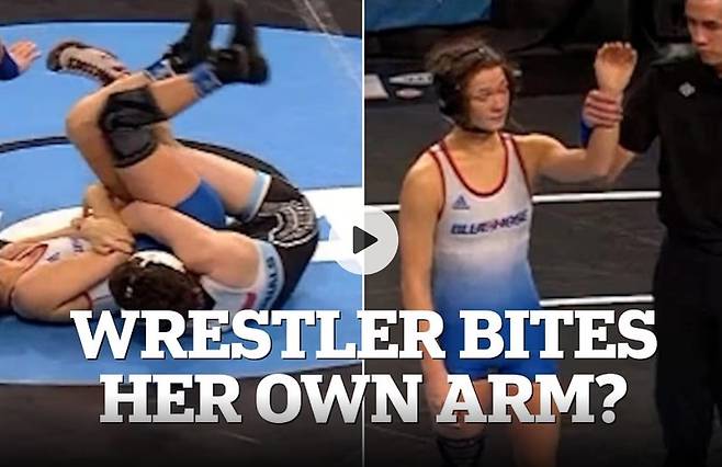 영국 '데일리 메일'은 7일(현지시간) "상대 선수를 실격시키기 위해 자신의 팔을 물어뜯었다는 의혹이 제기되며 사상 첫 NCAA 여자 레슬링 대회가 논란에 휩싸였다"고 보도했다. /사진=데일리메일 갈무리