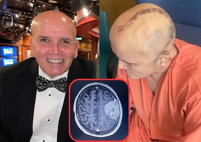영국 60대 남성이 뒤늦게 뇌종양을 진단받아 수술했지만, 이후로도 언어 기능에 문제가 생긴 안타까운 사연이 전해졌다. 사진=데일리메일