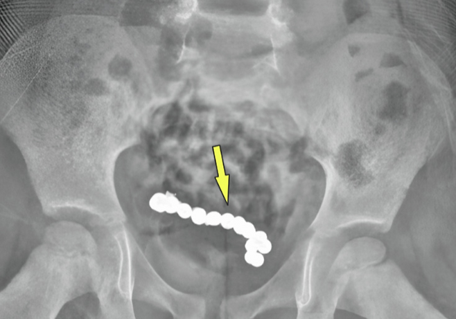 [큐레우스 갈무리]
