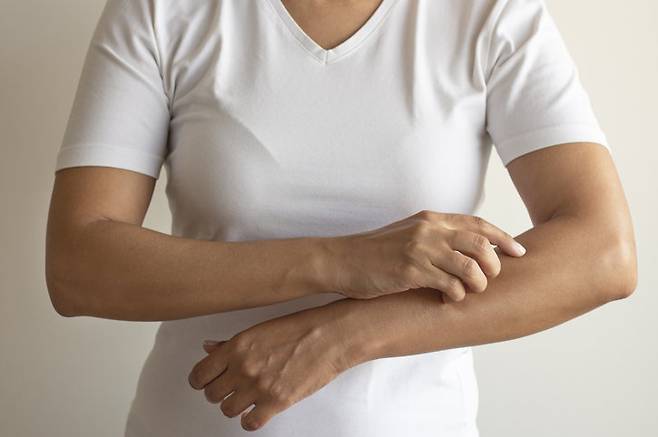 갱년기 가려움증은 에스트로겐 감소로 인해 콜라겐과 피부 두께가 급격히 줄어들며 발생한다. 사진=게티이미지뱅크.