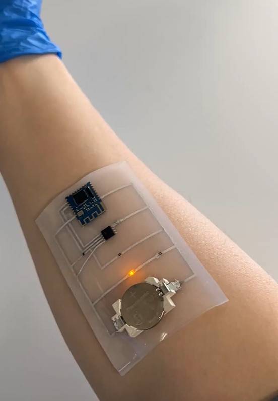 피부 부착형 무선 건강 모니터링 패치를 팔에 붙인 모습. KAIST 제공