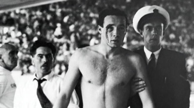 1956년 멜버른 올림픽 헝가리와 소련의 수구 경기에서 헝가리 선수 에르빈 자도르가 부상으로 피를 흘리고 있다. 이 경기는 냉전 갈등 속에서 벌어진 ‘수영장의 피’ 사건으로 불린다. [AP]