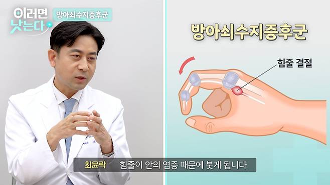 /조선일보 의학·건강 유튜브 '이러면 낫는다'