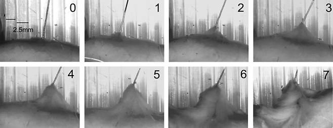 한의사가 침을 놓을 때 바늘을 돌리면 찌릿찌릿한 느낌이 든다. 세포 사이 공간인 간질의 연결체인 근막의 주성분인 콜라겐 섬유망이 힘을 받아 변형되며 전기신호가 발생한 결과다. 각 이미지의 숫자는 바늘의 회전수다. 미국국립과학원회보 제공