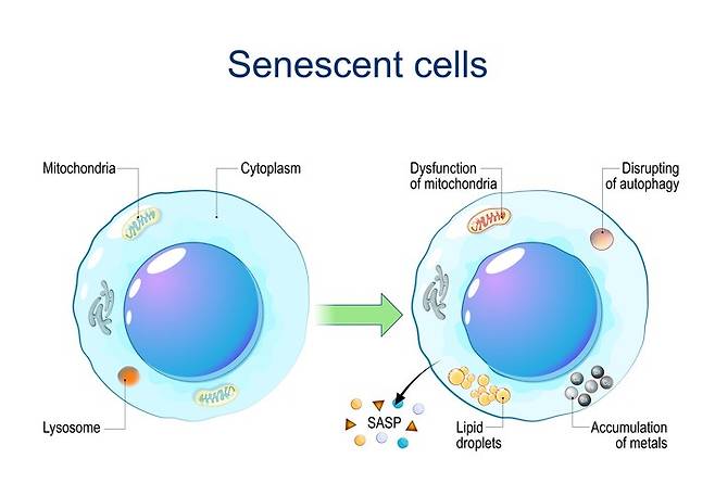 노화세포 일러스트레이션. 노화세포는 염증 물질을 분비하며 주변 조직 기능을 떨어뜨리는 것으로 알려져 있다. 사진=게티이미지뱅크