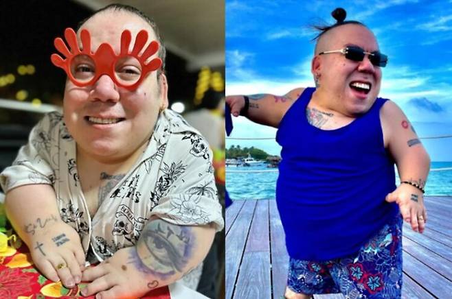 왜소증을 앓던 콜롬비아 30대 유명 틱톡커가 최근 사망했다. 사진=더선