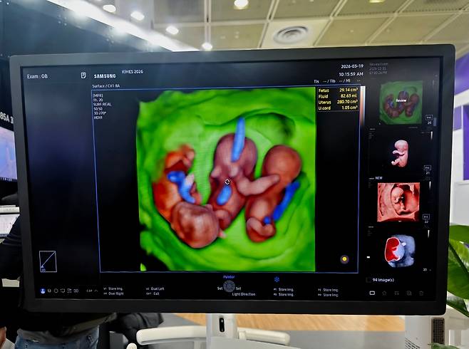 삼성메디슨은 19일 서울 코엑스에서 열린 KIMES 2026에서 인공지능(AI) 초음파를 선보였다. /홍다영 기자