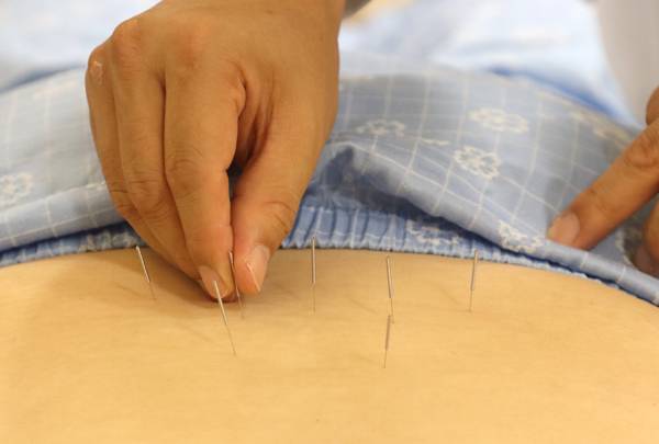 자생한방병원 의료진이 허리 통증을 호소하는 환자에게 침 치료를 실시하고 있다./자생한방병원 제공