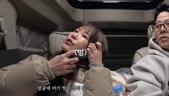 김지민은 얼굴이 퉁퉁 붓고 멍이 심하다고 설명했다. 사진=유튜브 채널 '준호 지민'