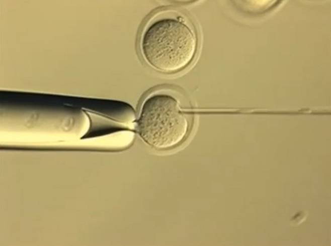 체세포의 핵을 생쥐 난자에 이식하는 핵이식 복제 과정. 야마나시대 제공