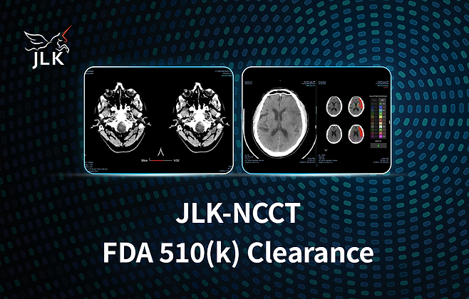 제이엘케이의 비조영 CT(NCCT) 기반 뇌졸중 분석 솔루션 'JLK-NCCT'가 미국 식품의약국 FDA 510(k) 승인을 받았다. /제이엘케이 제공