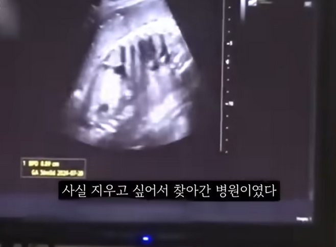 권 씨가 유튜브에 올린 임신 36주 차 초음파 영상 화면. 그는 아이가 움직이는 초음파 영상과 함께 ‘지우고 싶어 찾아간 병원’이라는 자막을 달았다. 권 씨의 채널은 현재 폐쇄됐다. 권 씨 유튜브 채널 브이로그 화면 캡처