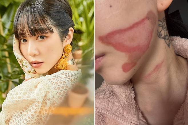 사진 | 권민아 SNS