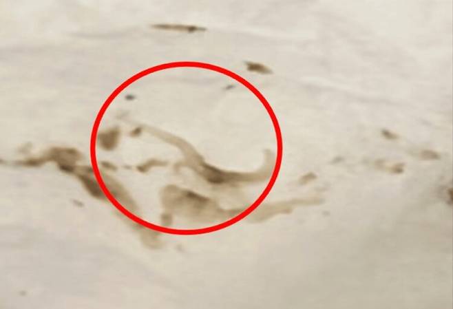 여성의 대변에서 채취한 기생충을 육안으로 확인한 모습. 약 1cm 크기의 구부러진 형태에 끝이 날카로운 갈고리 모양 기생충이다. 사진=큐레우스(Cureus)