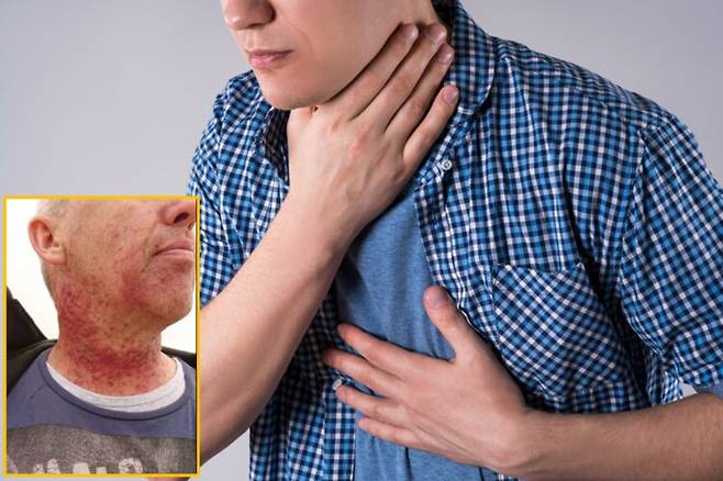 목이 아픈 증상이 나타나 체육관 리모델링 작업 중 발생한 먼지를 마신 탓이라 생각했던 한 남성이 인후암을 진단 받은 사연이 전해졌다.  배경사진=게티이미지뱅크 / 하단 사진=제프 브래드퍼트 제공