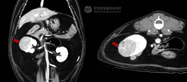 수술 전 정밀 평가를 위한 신장 CT 검사 결과 2.2x2.2x3.0㎝ 크기 종괴가 확인됐다(병원 제공). ⓒ 뉴스1