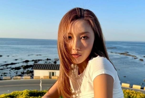 가수 화사가 첫 단독 콘서트를 앞두고 2도 화상을 입었다고 밝혔다. [사진출처 = 인스타그램]