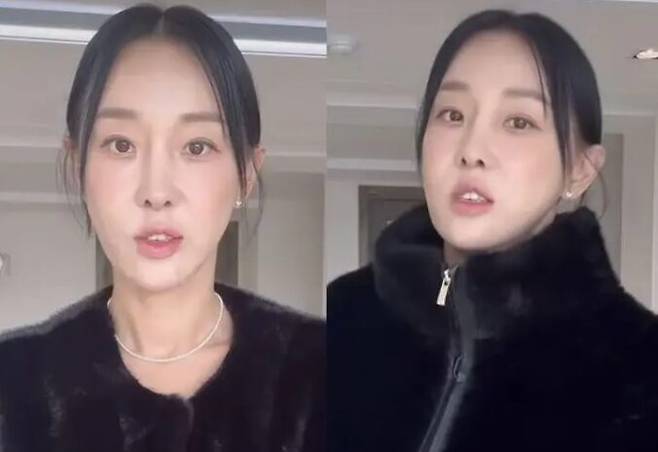 인중축소를 고백한 유명인들의 얼굴을 보면 턱끝이 뒤로 빠져 인중이 길어 보이는 얼굴입니다. 사진=이지혜 인스타그램