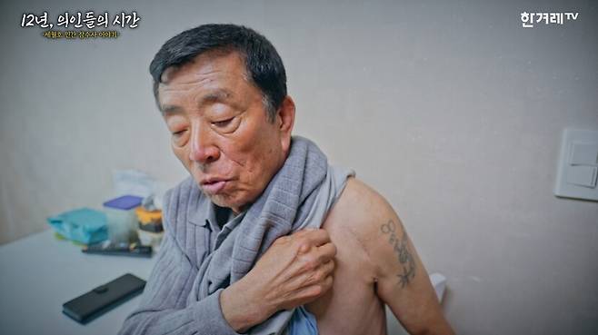 골괴사 수술 부위를 보여주는 김순종(75) 잠수사. 그는 세월호 참사 수습활동 이후 현업에 복귀하지 못하고 일용직 일을 하고 있다.